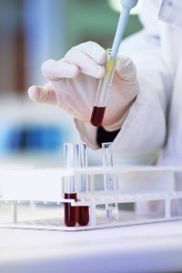 Biology lab test tube